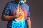 Silent Signs of Acid Reflux You Might Be Ignoring