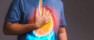 Silent Signs of Acid Reflux You Might Be Ignoring
