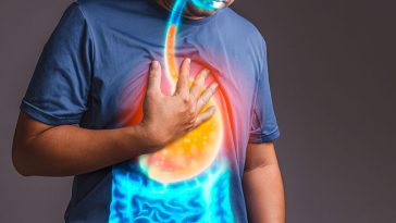 Silent Signs of Acid Reflux You Might Be Ignoring