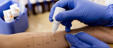 13 Skin Allergy Myths Everyone Needs to Stop Believing