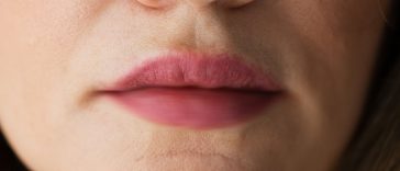 7 Reasons Your Lips are Tingling (#4 will surprise you)