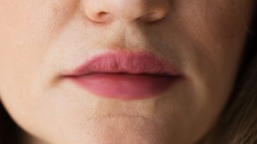 7 Reasons Your Lips are Tingling (#4 will surprise you)