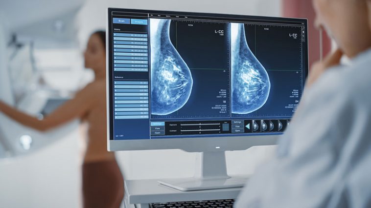 Two Things That Could Slow Down Aggressive Breast Cancer