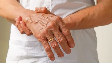 Numbness or Tingling in Your Hands Is One of the Early Signs of MS