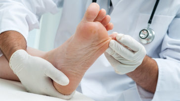 10 Subtle Signs of Dangerous Health Problems Your Feet Can Reveal