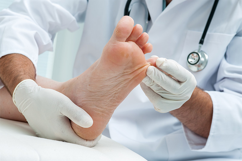 10 Subtle Signs of Dangerous Health Problems Your Feet Can Reveal