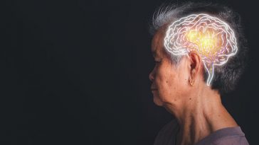 Mental Decline Could Predict a Stroke 10 Years Before It Happens