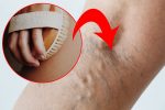 10 Vein-Damaging Habits That You Are Doing Every Day