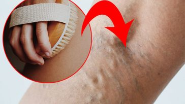 10 Vein-Damaging Habits That You Are Doing Every Day