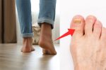 Your Feet Are In Contact With Bacteria