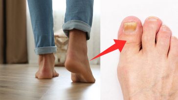 Your Feet Are In Contact With Bacteria