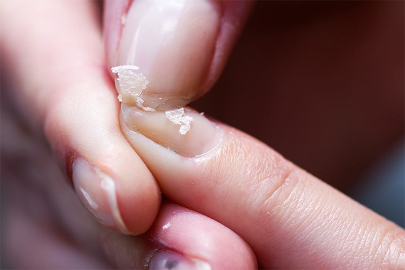 Dry Skin And Dry Nails