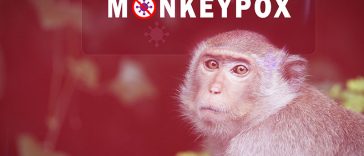Could You Have Monkeypox? Here Are The Signs That You Likely Do
