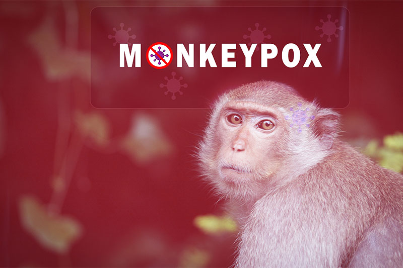 Could You Have Monkeypox? Here Are The Signs That You Likely Do