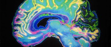 Study Shows That Most People Who Develop Alzheimer’s Show This Symptom First