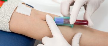 Why Do You Need To Fast Before Certain Blood Tests?