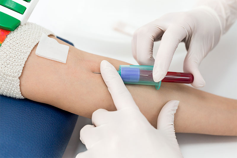 Why Do You Need To Fast Before Certain Blood Tests?