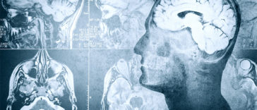 11 Brain Exercises to Help Keep You Mentally Sharp