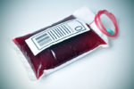 Whether you are a universal donor or recipient