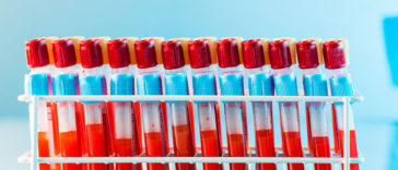 8 Reasons Everyone Should Know Their Blood Type