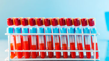 8 Reasons Everyone Should Know Their Blood Type