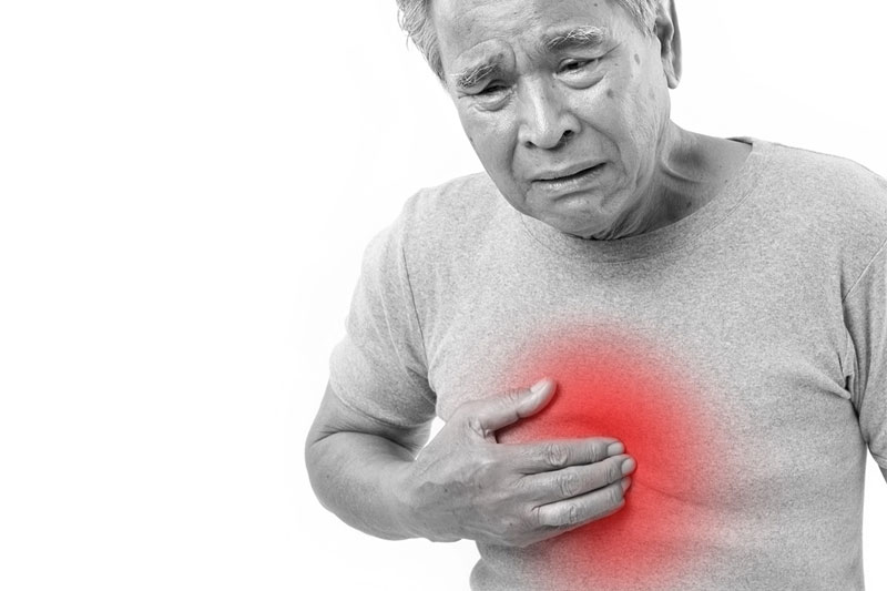 Gastroesophageal Reflux (GERD)