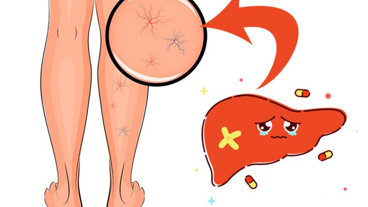 Never Ignore These Early Warning Signs of Liver Disease