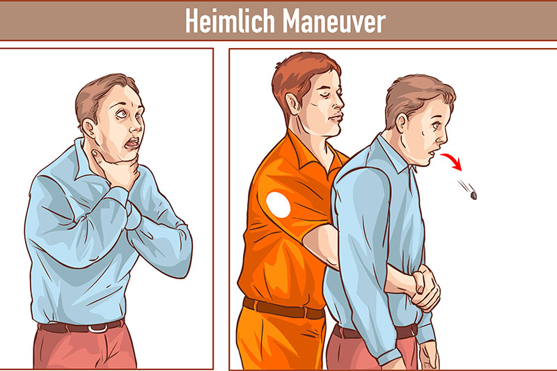 Choking Heimlich maneuver 