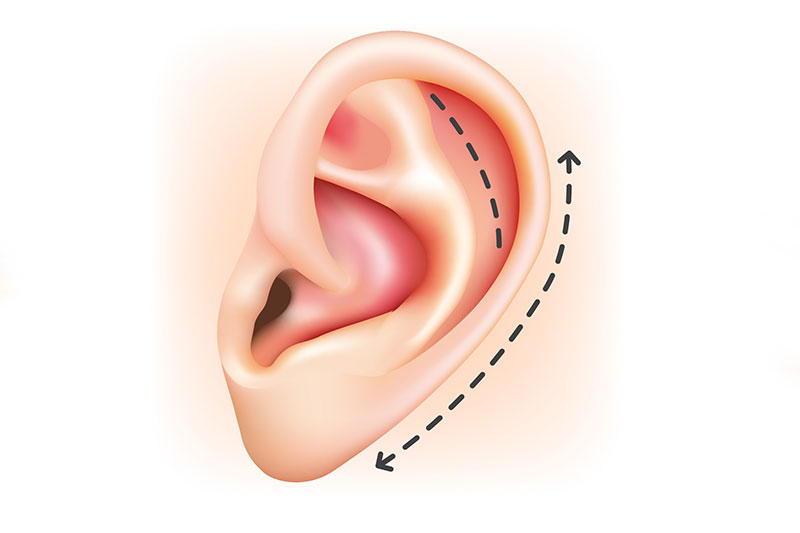 Ear Surgeries