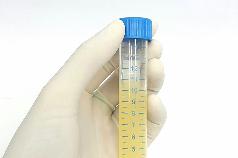 cloudy-urine-treatment