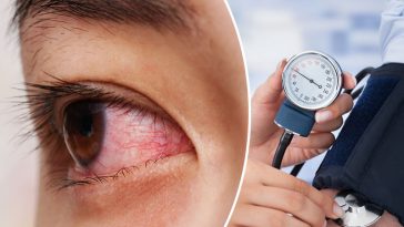 8 Early Warning Signs of High Blood Pressure that 1 in 5 People Do Not Know They Have It