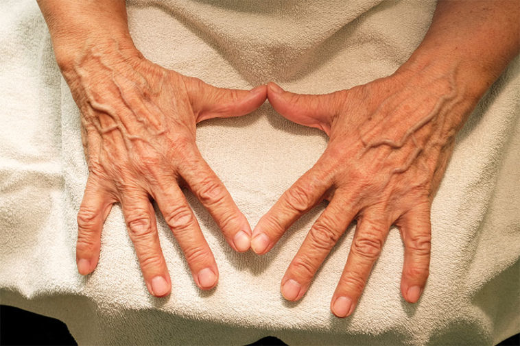 7 Ways To Help Prevent And Fade Crepey Skin Factspedia