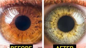 7 Kinds of food that can change the color of your eyes!