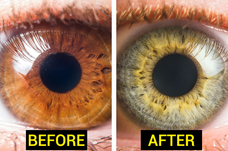7 Kinds of food that can change the color of your eyes!