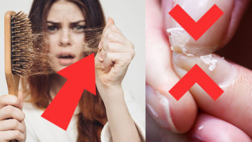 10 Foods You Need to Eat If You Have Hair Loss, Brittle Nails Or You’re Not Sleeping