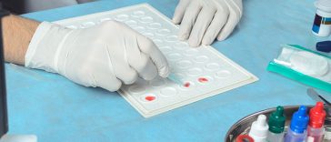 Your Stomach Cancer Risk Increases If You Have This Blood Type