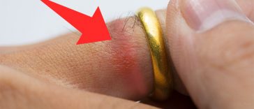 Got Sensitive Skin? The 20 Most Common Skin Irritants You Must Avoid