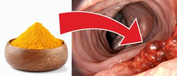 Fight Colon Cancer By Eating These 5 Tasty Spices!