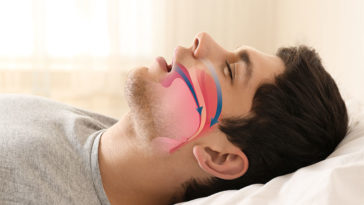 7 Hidden Health Risks of Uncontrolled Sleep Apnea