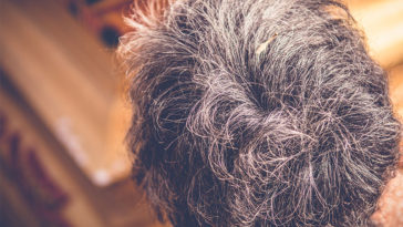 Understanding the Science of Gray/White Hair