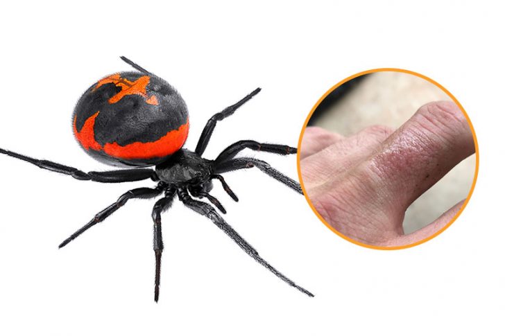 12 Bug Bites Anyone Should Be Able To Identify Factspedia 12 Bug Bites Anyone Should Be Able To Identify Factspedia