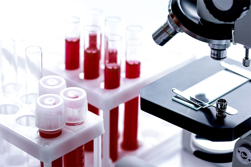 What Can You Do Before You Get A Blood Test While Fasting?