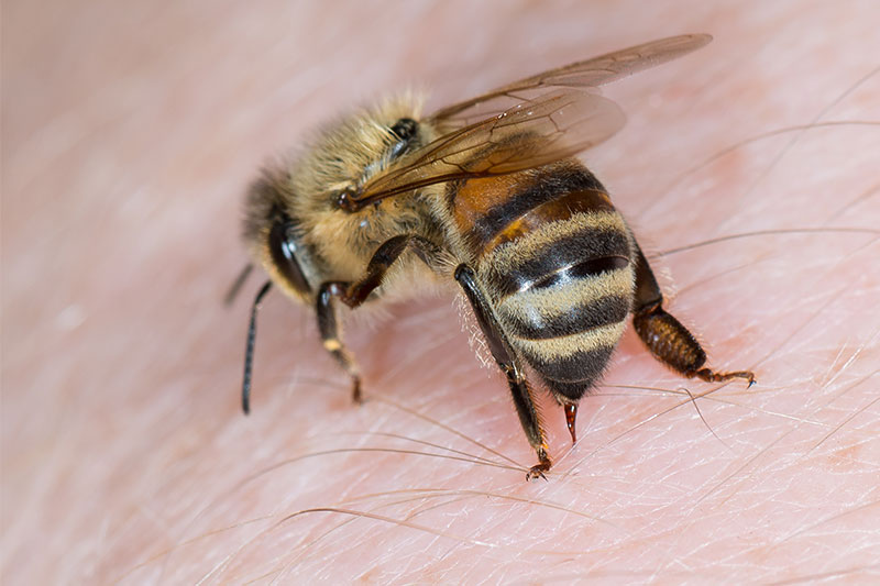 Bee Sting