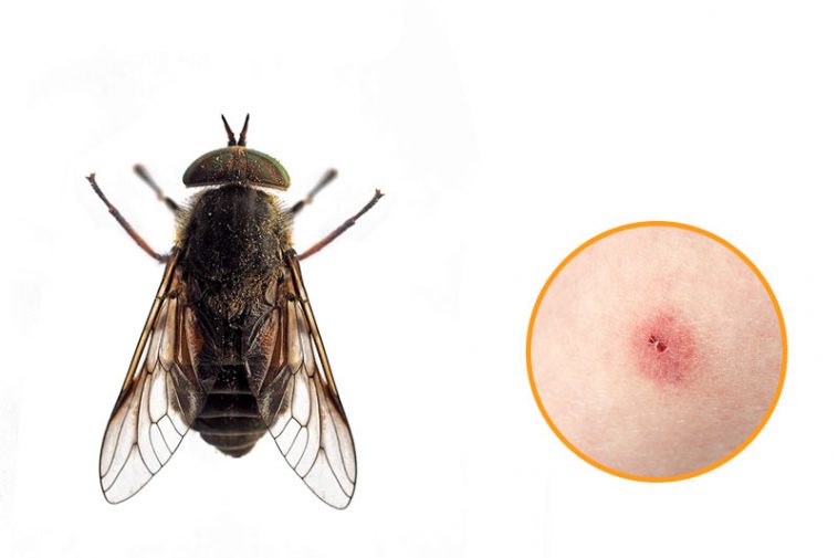 12 Bug Bites Anyone Should Be Able To Identify Factspedia 12 Bug Bites Anyone Should Be Able To Identify Factspedia