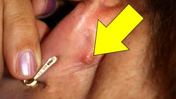 Do You Sometimes Have A Strange Little Bump Behind Your Ear? THIS Is What It Means!