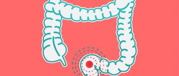 8 Ulcerative Colitis Symptoms That Should Be on Your Radar
