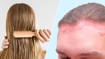 7 Illnesses Caused By Sleeping With Wet Hair