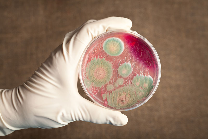 10 Biggest Health Scares on the Planet Anthrax