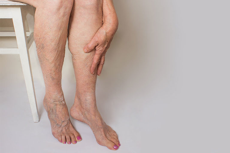 7 Dangerous Signs of Blocked Arteries We Often Ignore Factspedia