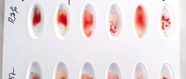 Why Is It Important To Know Your Blood Type?
